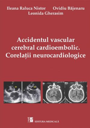 Accidentul vascular cerebral cardioembolic. Corelatii neurocardiologice