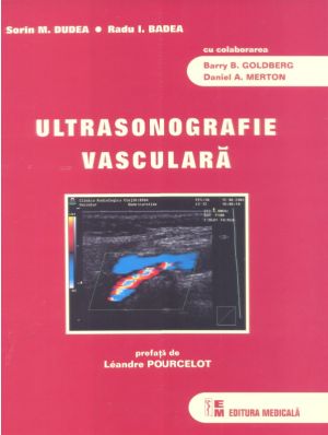 Ultrasonografie vasculara